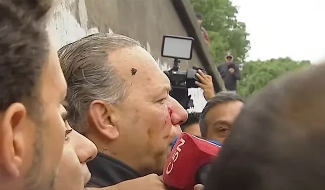 El ministro Berni recibió golpes que le generaron heridas cortantes en la cara.&nbsp;