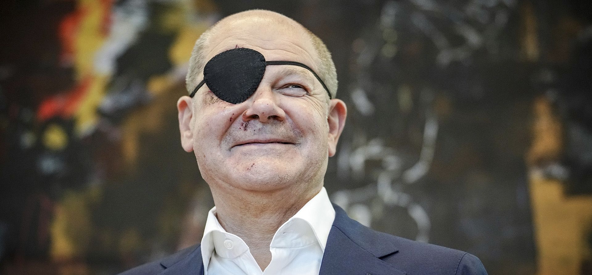 El canciller alemánr Olaf Scholz ha tuiteado una foto de sí mismo al estilo pirata con un parche negro en el ojo y moretones de color rojo oscuro en el lado derecho de la cara, resultado de un accidente al correr el fin de semana. El canciller escribió el lunes en el pie de foto de la foto que estaba “emocionado de ver los memes”. (Kay Nietfeld/dpa vía AP) El canciller alemánr Olaf Scholz ha tuiteado una foto de sí mismo al estilo pirata con un parche negro en el ojo y moretones de color rojo oscuro en el lado derecho de la cara, resultado de un accidente al correr el fin de semana. El canciller escribió el lunes en el pie de foto de la foto que estaba “emocionado de ver los memes”. (Kay Nietfeld/dpa vía AP)