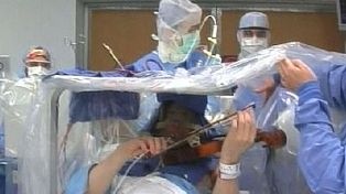 Tocó el violín mientras le practicaban una cirugía en el cerebro