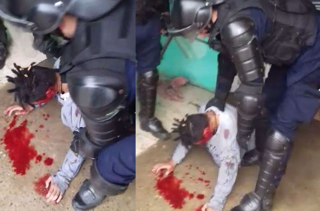 Pese a los esfuerzos médicos, el joven baleado por la Policía perdió el ojo
