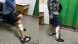 Ataque a tiros en Alto Verde: un delincuente intentó asaltar a dos hermanos y los hirió con una escopeta