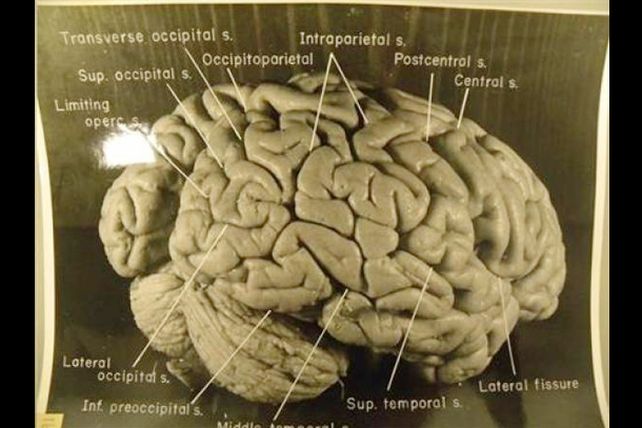 Revelan que el cerebro de Einstein era inusual