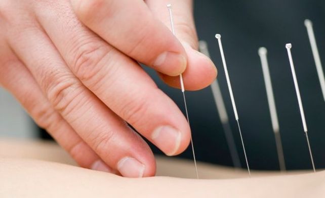 La acupuntura permite tratar síntomas dolorosos producidos por traumas