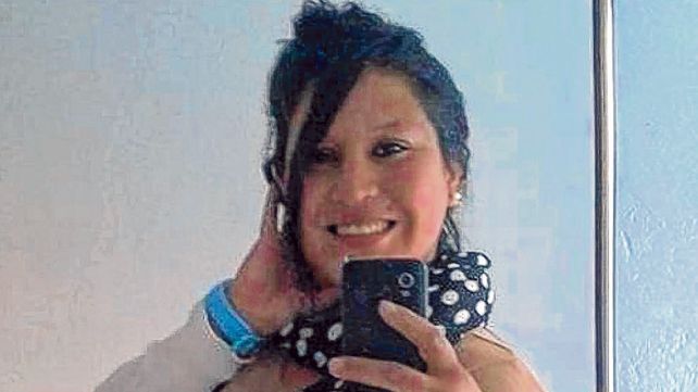 Yanina Dalma Miranda. La mujer sufrió quemaduras en el 45% de su cuerpo