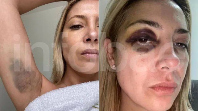 Imágenes de Fabiola Yáñez que refuerzan la denuncia de violencia de género contra Alberto Fernández.