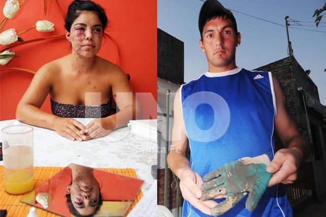 Hablaron las víctimas de las dos bombas en barrio Liceo Norte