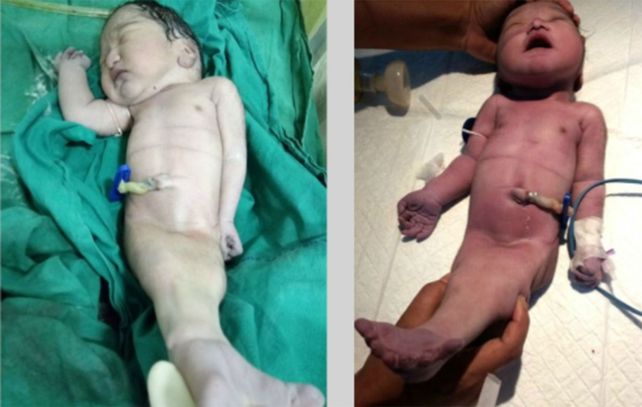 La triste muerte de un bebé sirena