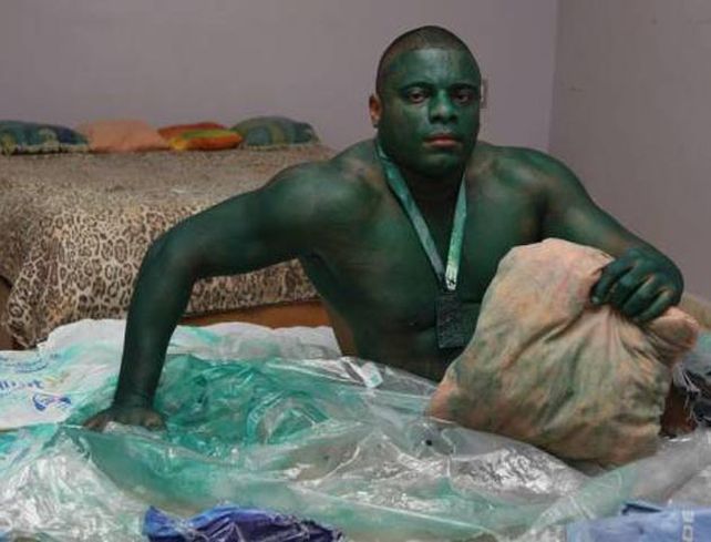 Un hombre hulk brasileño no consigue volver a su piel normal