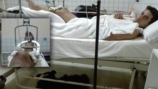 Carlín, el jinete que sufrió dos fracturas en su pierna derecha.