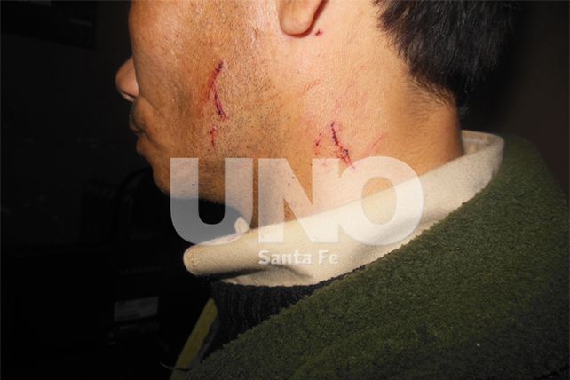 Asaltaron a un remisero, escaparon y fueron apresados por el comando