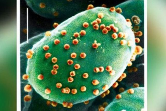 Científicos afirman que un virus es la causa de la estupidez