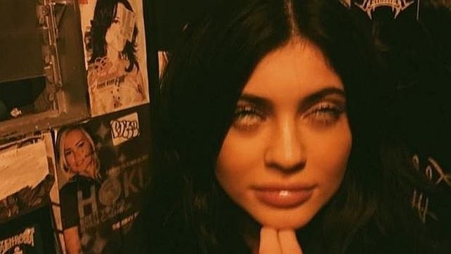 ¿Qué le pasa a Kendall Jenner?