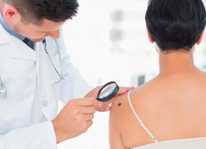 Melanoma: Prevención, autocontrol y chequeo dermatológico