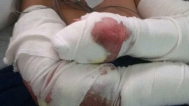 demencial. Los perros estaban sueltos y atacaron dos veces en 60 días.