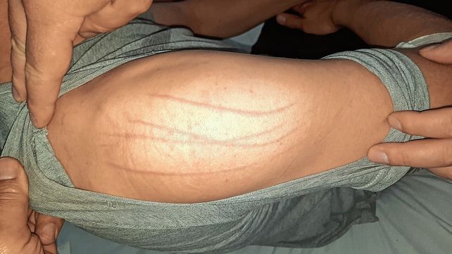 Miedo y lesiones: habló el policía atacado por un extraño ente en las celdas