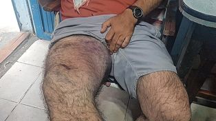 Las marcas tras el hecho de violencia que sufrió Mario en la noche del jueves en barrio Mariano Comas.
