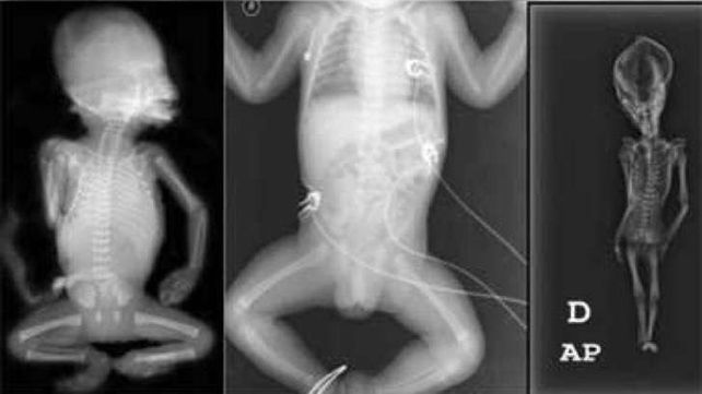 El gran descubrimiento y misterio sobre un supuesto alien