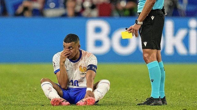 Mbappé sufrió la fractura en el tabique y está en duda en Francia para el resto de la Eurocopa Mbappé sufrió la fractura en el tabique y está en duda en Francia para el resto de la Eurocopa