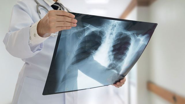 8 de Noviembre: Día Internacional de la Radiología