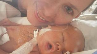 Luz Milagros cumple un año y espera trasplante de células madre que le harían en China
