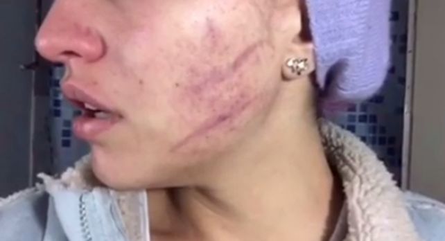 Golpeó brutalmente a una estudiante de teatro para que entrara en el personaje