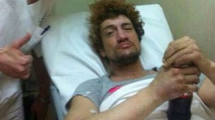 El músico Pity Alvarez se accidentó con su moto y sufrió múltiples fracturas