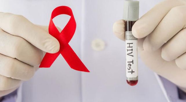 hiv test