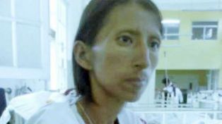 Una peruana que creía que estaba embrujada padece sida