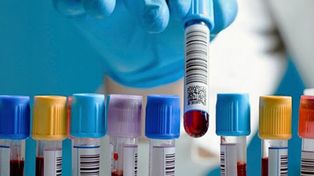 ¿Qué información y que utilidad tienen la pruebas bioquímicas Covid-19?