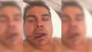 Falsos policías asaltaron a camionero entrerriano