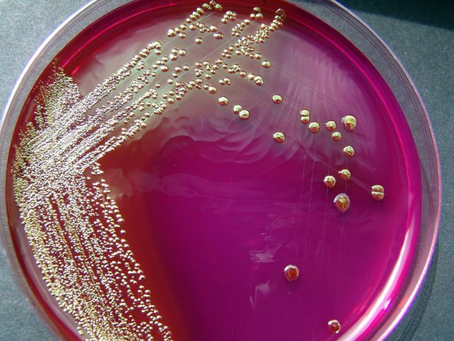 Logran producir una nafta sintética con la bacteria de la Escherichia coli
