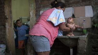 La difícil vida de José, un bebé cuya madre fue contagiada de zika