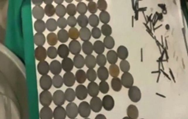 Parte de las monedas y los objetos metálicos extraidos del estómago de Singh.