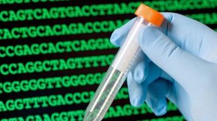 Un gran avance en nuestro país para el estudio del Alzheimer