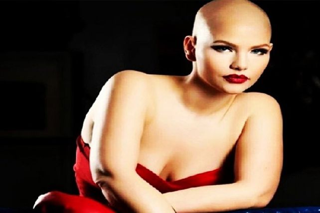 Una modelo con cáncer se muestra sin pelo en sus campañas