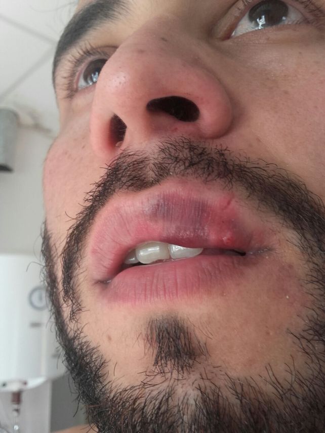 Árbitro golpeó a un técnico de Futsal hasta hacerlo convulsionar