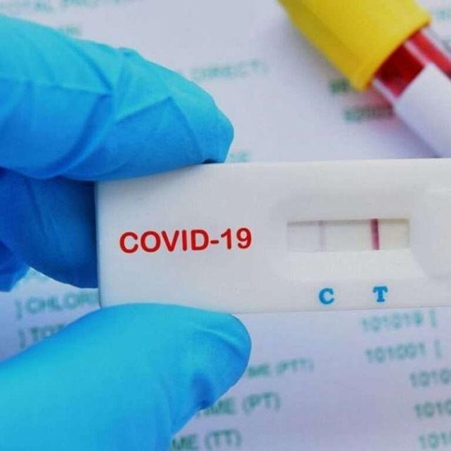 Los test costarán unos 3 mil pesos cada uno.