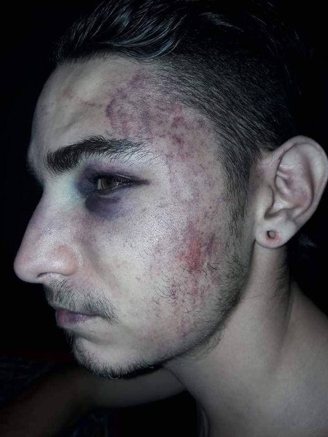 Una de las víctimas terminó con varios golpes en la cara y el cuerpo