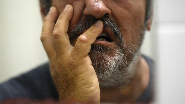 Los cambios de hábito, el aislamiento, el estrés y la angustia tiene efectos negativos en la cara y la cavidad bucal.