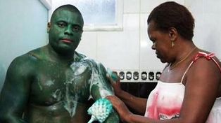 Un hombre hulk brasileño no consigue volver a su piel normal