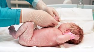 Hay familias rosarinas que impiden la aplicación de una vitamina obligatoria en recién nacidos