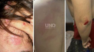Una pelea de perros derivó en una pelea de vecinos donde un adolescente de 15 años fue agredido a palazos