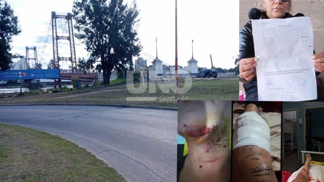 Otro caso de choque y fuga en Santa Fe. Denuncian que un auto en contramano los embistió. Buscan al conductor y piden testigos. Otro caso de choque y fuga en Santa Fe. Denuncian que un auto en contramano los embistió. Buscan al conductor y piden testigos.