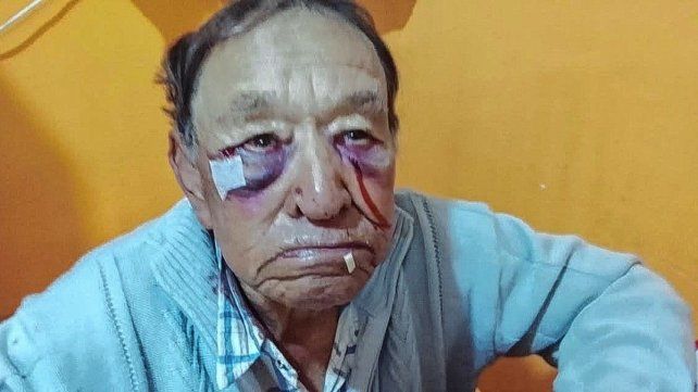Violento episodio en Domínguez: investigan agresión a un hombre en un establecimiento de salud.