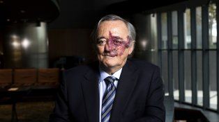 Barbacid sale a limpiar el hallazgo de la terapia contra el cáncer de páncreas