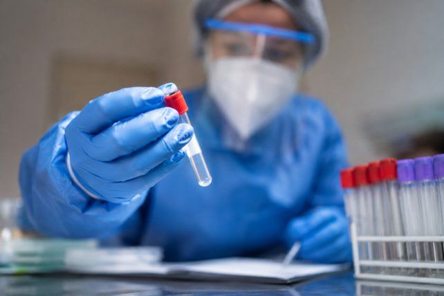 Aumento de casos de psitacosis y leptospirosis en Santa Fe
