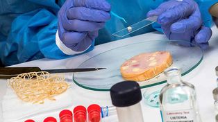 Tras un brote de listeriosis desde la Facultad de Bromatología brindan datos para prevenir esta enfermedad transmitida a través de alimentos