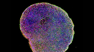 Un organoide cerebral, hecho con el cultivo de neuronas. Se unió a un chip electrónico.&nbsp;