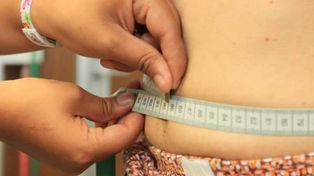 La obesidad puede prevenirse, seg&uacute;n la OMS.