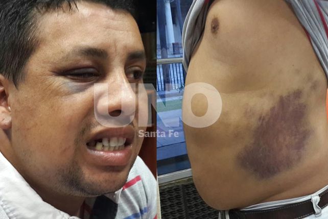 Pastores evangélicos denunciaron que policías les dieron una feroz golpiza